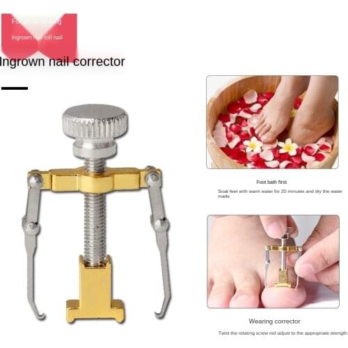 Ingrown Toenail Toe Fixer Recover Correction Device Pedicure Foot Nail Care Tool Easy to Use
