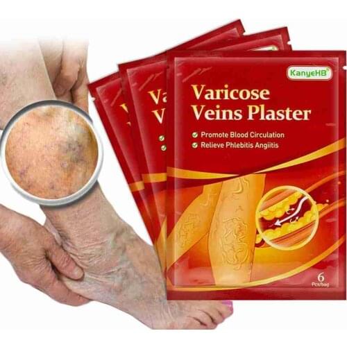 6pcs/bag Varicose Veins Ointmnet Vasculitis Phlebitis Spider Cream Varicosity Angiitis Removal Herbal Medical Plaster Patches