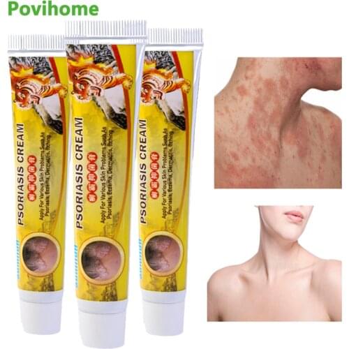 Sumifun 3 PCS Tiger Balm Skin Problem Treatment Eczema Psoriasis Dermatitis Ointment Herbal Antibacterial Cream Anti-Itch Plaste