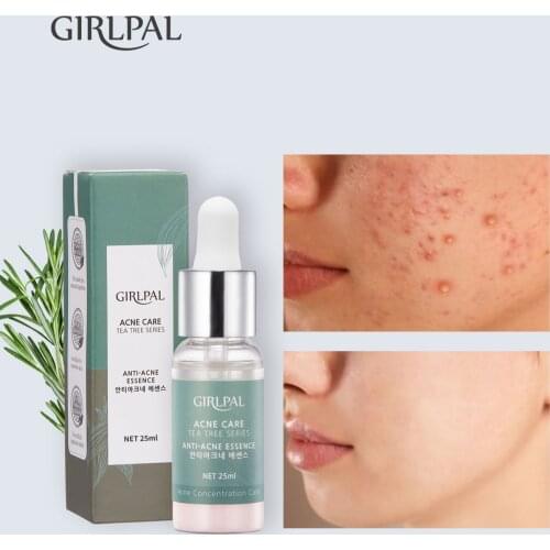 Girlpal Whitening Face Serum