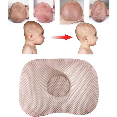 Flat Head Pillow Baby Head Styling Pillow Pediatri Uzmanlarının Proposal flat head syndrome Treatment