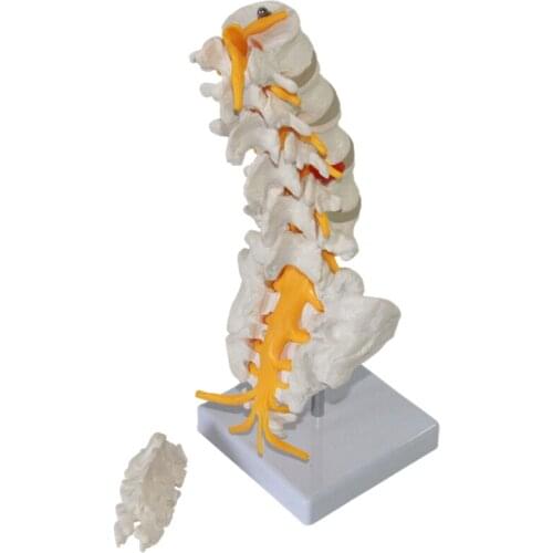 Five section lumbar vertebrae model cauda equina neurological model vertebral intervertebral disc