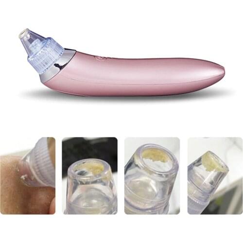 Moonvvin Vacuum Pore Cleaners