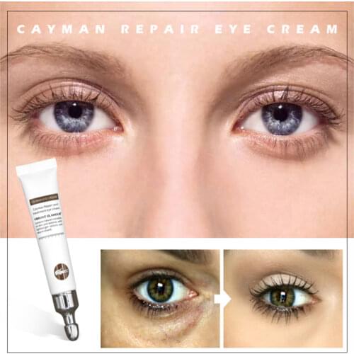 VIBRANT GLAMOUR Hyaluronic Acid Eye Cream Serum Crocodile Repair Eye Cream Anti-wrinkle Age Remover Dark Circles Eye Care TSLM1