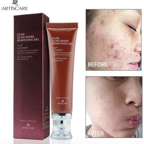 Collagen Anti Cicatrice Ancienne Acne Treatment Cream Scar Stretch Marks Rugas Removal Eclaircissant Cremas Faciales Manchas