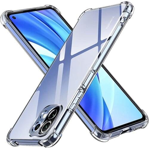 Xiaomi Mi 11 Phone Cases Sojeryr China
