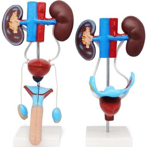 Male/female genitourinary system model kidney anatomy mold bladder ureter structure stereoscopic teaching