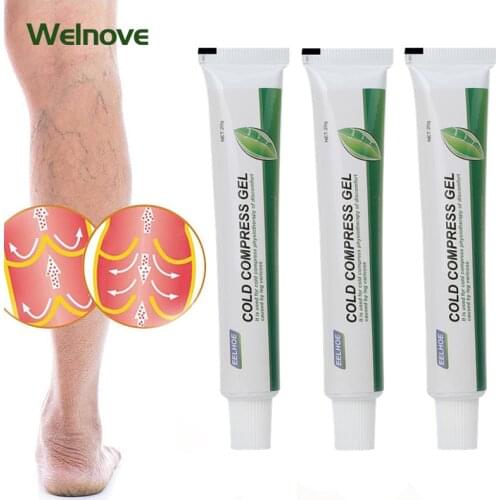 20g Phlebitis Vasculitis Varicose Vein Cream Cold Compress Gel Treatment Ointment Varicosity Herbal Extracts Leg Swelling Relief