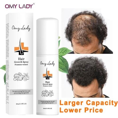 OMY LADY Hair Growth Spray Effective Fast Hair Growth Anti Hair Loss Essential Oil Hair Regeneration Repair Damaged Hair Care