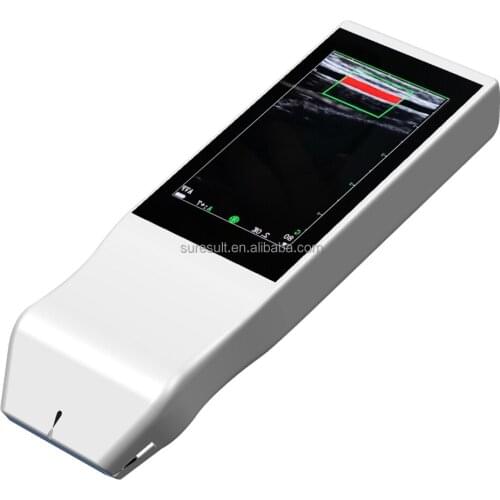 Suresult Portable Touch Screen Ultrasound Scanner Color Doppler Vascular Linear Probe