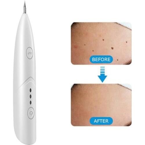 Electric Mini Mole Removal Spot Removal Pen Wart Remover Skin Tag Removal Machine Spot Cleaner Beauty Care