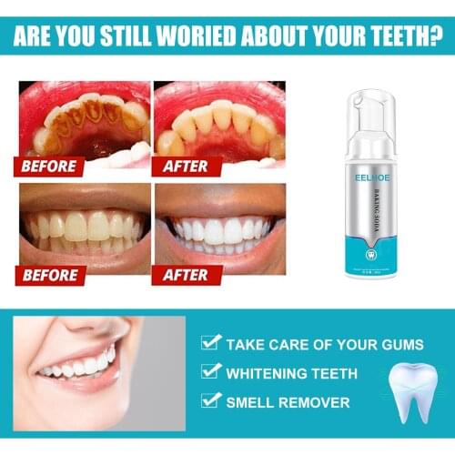 Отбеливающие зубные пасты Gazechimp China At AliExpress