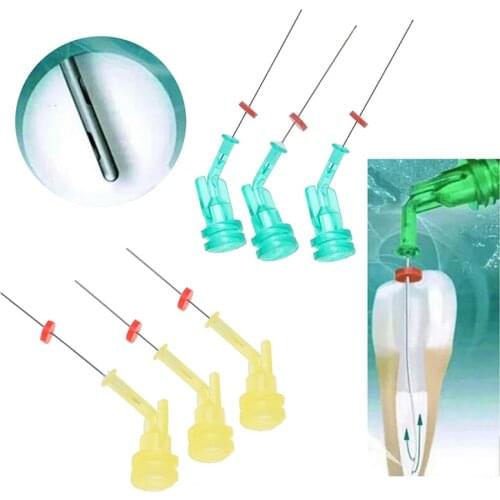 2Pcs Reusable Dental Endo Irrigation Needle Tip Elbow Double Side Hole For Root Canal Cleaning Syringe Anterior & Molar Teeth