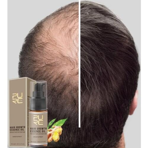PURC 20ml Ginger Extract Hair Growth Essential Oil Hair Speed Promotes Hair Growth Nourish Thick Roots Hair Loss Treatment