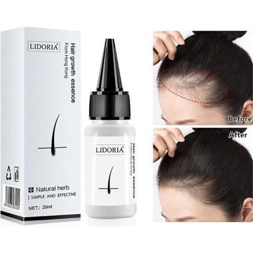 1* Fast Hair Growth Serum Hair Care Essence Hair Loss Treatments Hair Serum Eyelash Eyebrow Thick Health Beauty Supplies