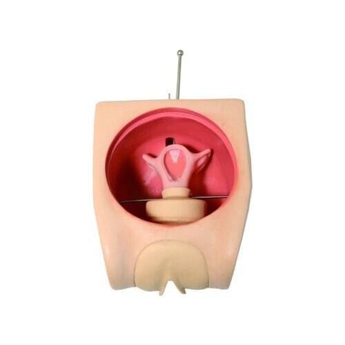 Advanced teaching model train and check the upper ring taking model intrauterine contraceptive device