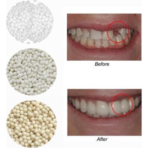 3Colors Dental Oral False Fake Teeth Tooth Filling Repair Smile Snap on Veneers Dentures Case Paste Adhesive Beads Cosmetic Sets