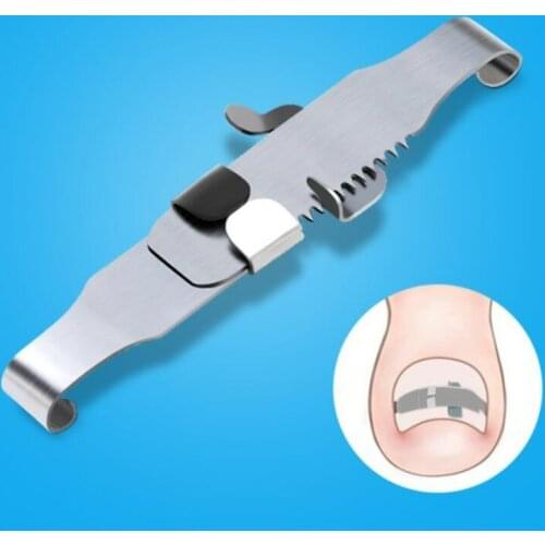 Ingrown toenail corrector Tools Pedicure Recover Embed Toe Nail Treatment professional Ingrown toenail correction Foot Care Tool