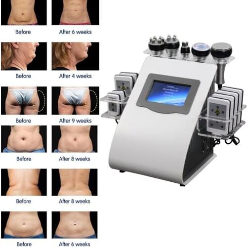 Hot Product 6 in 1 Vacuum Laser Radio Frequency RF 40K Cavi Lipo Slimming Ultrasonic Liposuction Cavitation Machine For Spa