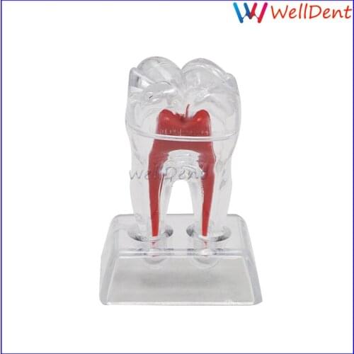 Dental Tooth Molar Teeth Model Crystal Base Hard Plastic Teeth Separable Tooth Dental Lab