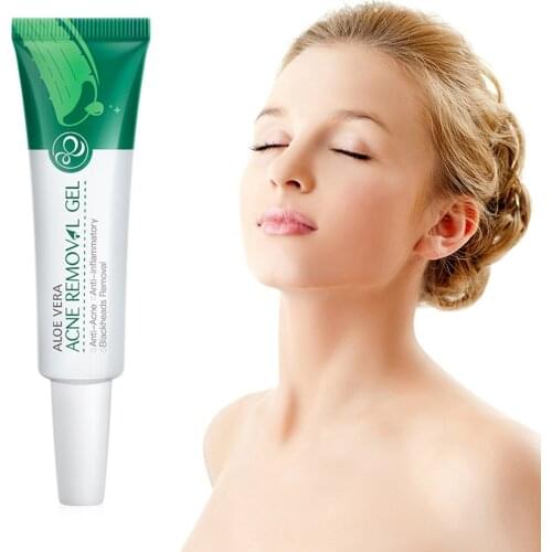 Aloe Acne Treatment Gel Face Cream Serum Anti Acne Scar Cream Shrink Pores Moisturizing Oil Control Soothing Essence Skin Care