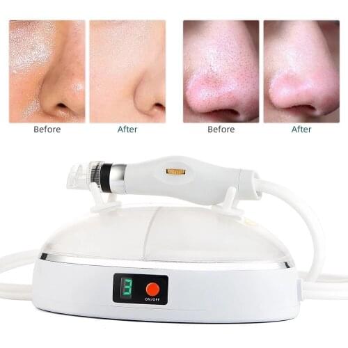 Facial Nanoscale Bubble Machine Rechargeable Face Microbubble Cleanser Hydrate Skin Cleansing Pores Blackhead Remover Anti Acne