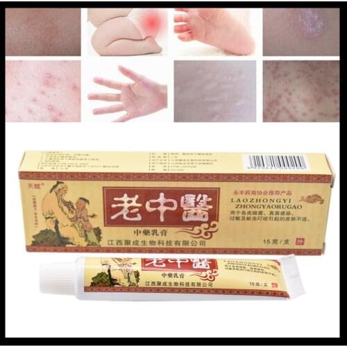 No box YIGANERJING laozhongyi 100% Original Powerful Professional Cure Psoriasis Ointment Native Medicine Ingredient Security