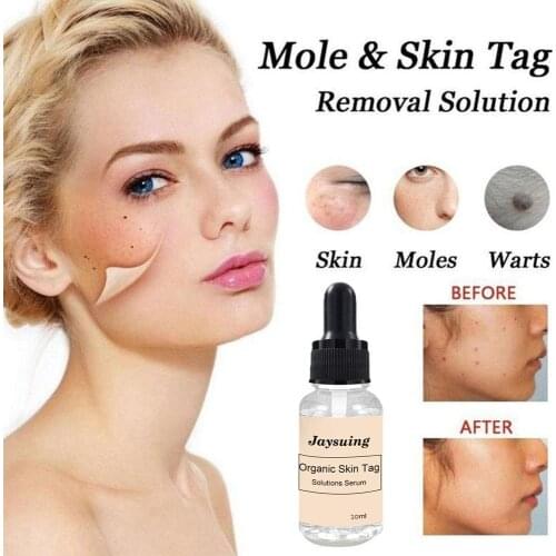 Non-Trace Removal Moles Potion Blackhead Remover 12 Hours Medical Fast Repair Skin Tag Mole Dark Spot Face Beauty Skin Care Tool