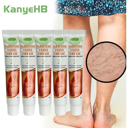 5pcs Leg Varicose Veins Ointmnet Treatment Vasculitis Varicosity Angiitis Removal Herbal Medical Plaster Phlebitis Cream A643