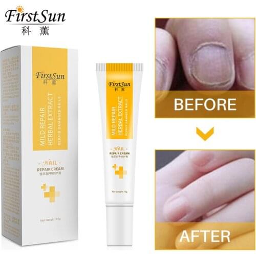 Nail Repair Cream Protector Skin Care Cream Antifungal Feet Care Cream Removal Gel Paronychia Onychomycosis Whitening Toe TSLM2