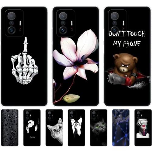 DENZ BRO Xiaomi Phone Cases