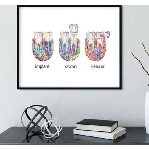 Tooth Implant Art Canvas Painting Dental Crown Print Dentist Gift Tooth Anatomy Medical Wall Art Picture Dental Clinic Decor