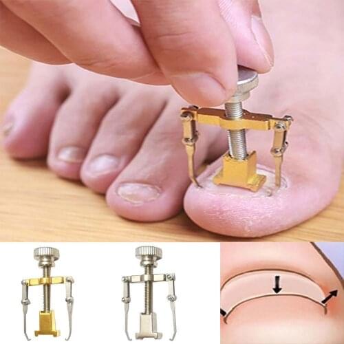 Curly Toenail Corrector Orthopedic Nail Sticking Nail Ditch Painful meat Nail-coated Forceps Toe nail Fix Care Tool