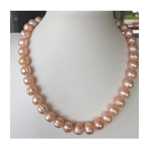 Elegant 9-10mm baroque gold pink pearl necklace 18inch 14k