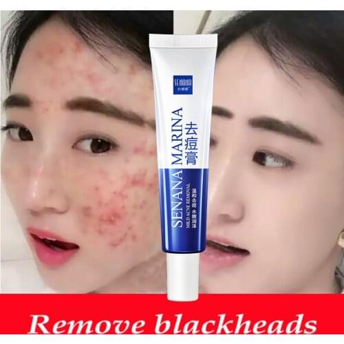 LAIKOU Acne Treatment Gel Blackhead Remove Face Cream Shrink Pores Scar Remove Anti Acne Whitening Face Cream Skin Care