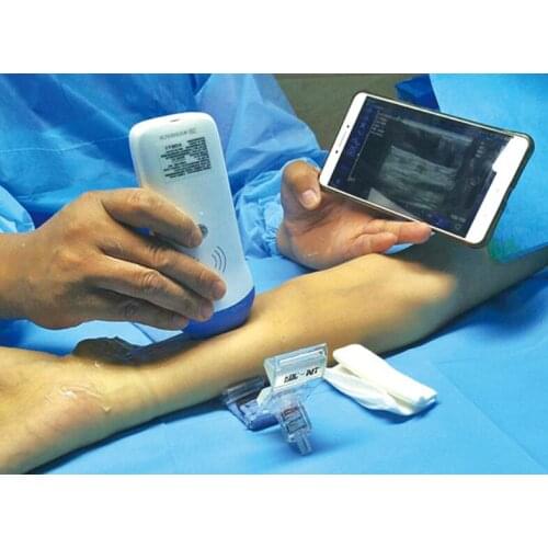 Convex & Linear Wireless Probe Type Ultrasound Scanner Double Head Transvaginal XProbe UProbe-20 available wireless charge