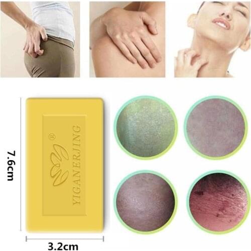 1pcs Sulfur Soap Removal Acne Pimple Pore Treatment Psoriasis Seborrhea Eczema Anti Fungus Bath Whitening Shampoo Soap T1219