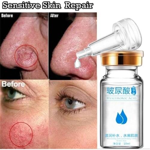 10ml Hyaluronic Acid Anti-Spider Vein Oil Face Redness Removal Red Blood Silk Repair Essential Oil Sensitive Skin Face Treatment