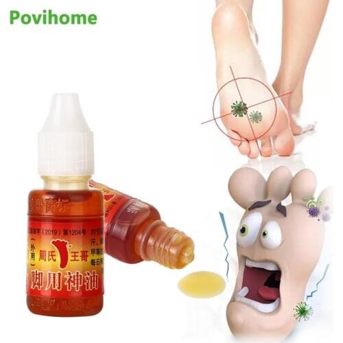 10ml Foot Beriberi Oil Athletes Foot Plaster Erosive Beriberi Remove Sweat Odor Psoriasis Peeling Antibacterial Ointment Care