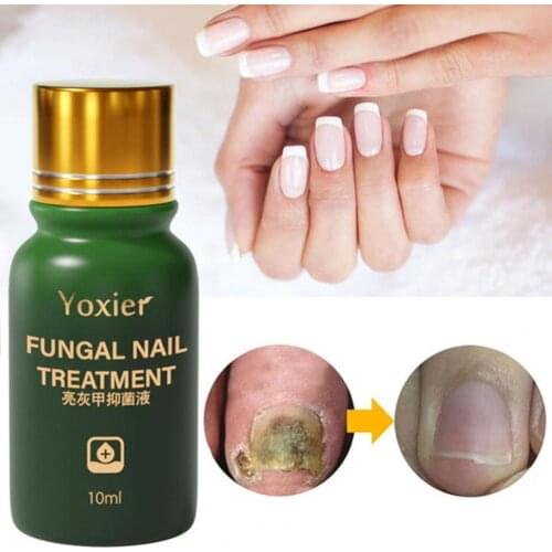 Anti Infection Nail Care Nail Treatment Antibacterial Serum Foot Care