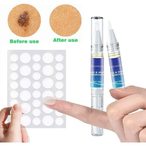 Skin Tags Wart Remover Pen+Sticker Treatment Papillomas Removal Warts Liquid From Skin Tags Removing Moles Remover Wart Removal