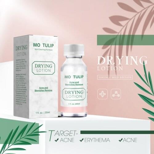 30ml Effective Acne Treatment Drying Lotion Anti Acne Serum Pimple Blemish Removal