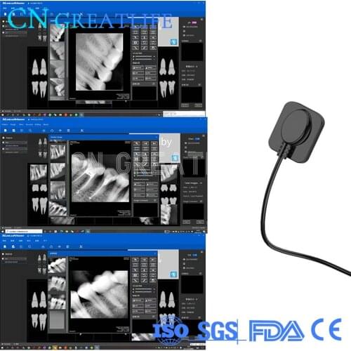 Cheap Price High Quality Intraoral Imaging System Digital Usb2.0 Dental Sensor X-ray Dental Sensor X-ray Dental Sensor