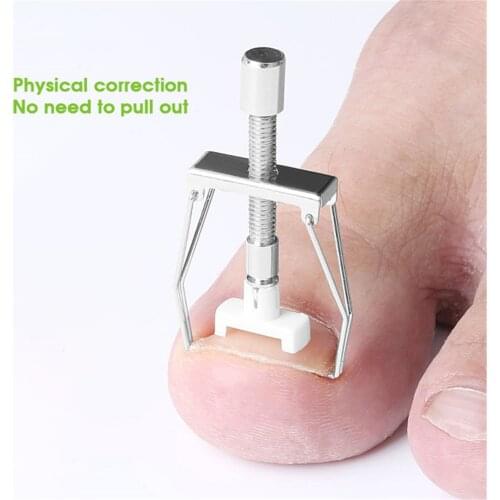 Ingrown Nail Recover Correction Pedicure Toenail Fixer Ingrown Foot Nails Care Tool Orthotic Toe Nail Corrector Pedicure Tool