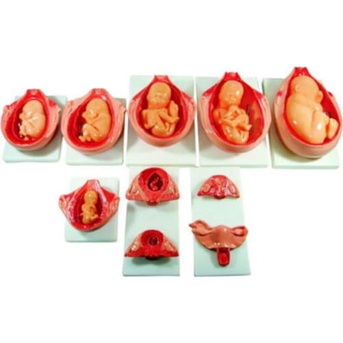 Life Size 10 Parts Fetus Development Process Anatomical Model