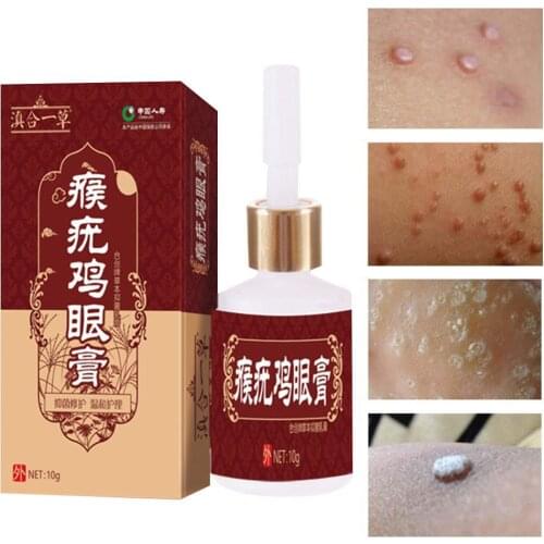 Effective Skin Tag Remover 12 Hours Tu Kill Medical Tu Genital Corn Wart Foot Remov Remover Tag Kill 10ml Mole Remover Skin C1M8