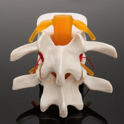 School Supplies Medical Instrume Human Anatomy Skeleton Spine Lumbar Disc Herniation Teaching Model brain skull traumatic pistol