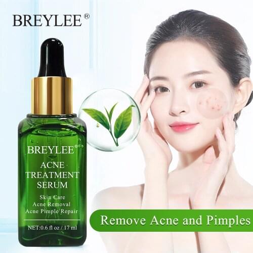 BREYLEE Acne Treatment Serum Face Facial Essence Anti Acne Scar Removal Cream Skin Care Whitening Repair Pimple Remover For Acne