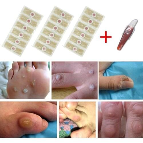 6/12/18/24pcs Foot Care Sticker Calluses Remove Patch Corn Removal Pads Warts Thorn Curative Patches Callosity Detox Foot Care