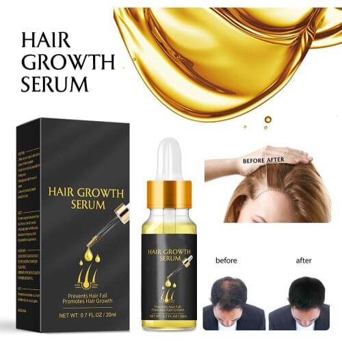 MO TULIP Powerful Hair Growth Essence Hair Loss Products Essential Oil Liquid Treatment Preventing Pomade Loss Hair Care Product
